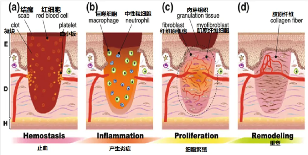 Stages of wound healing: hemostasis, inflammation, proliferation, remodeling